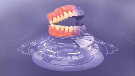 3D Printed Digital Dentures .